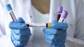 Güney Kıbrıs'ta 3 binden fazla kişi incelendi