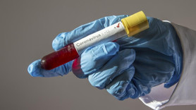 KKTC'de 7 yaşındaki çocukta koronavirüs çıktı