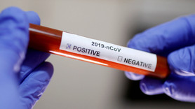 Sağlık Bakanlığı'ndan antikor testleri için uyarı